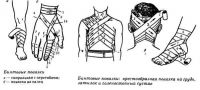 Бинтовые повязки