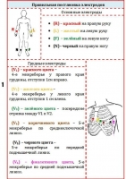 Шпаргалка по снятию и чтению ЭКГ