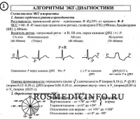 Шпаргалка по расшифровке ЭКГ