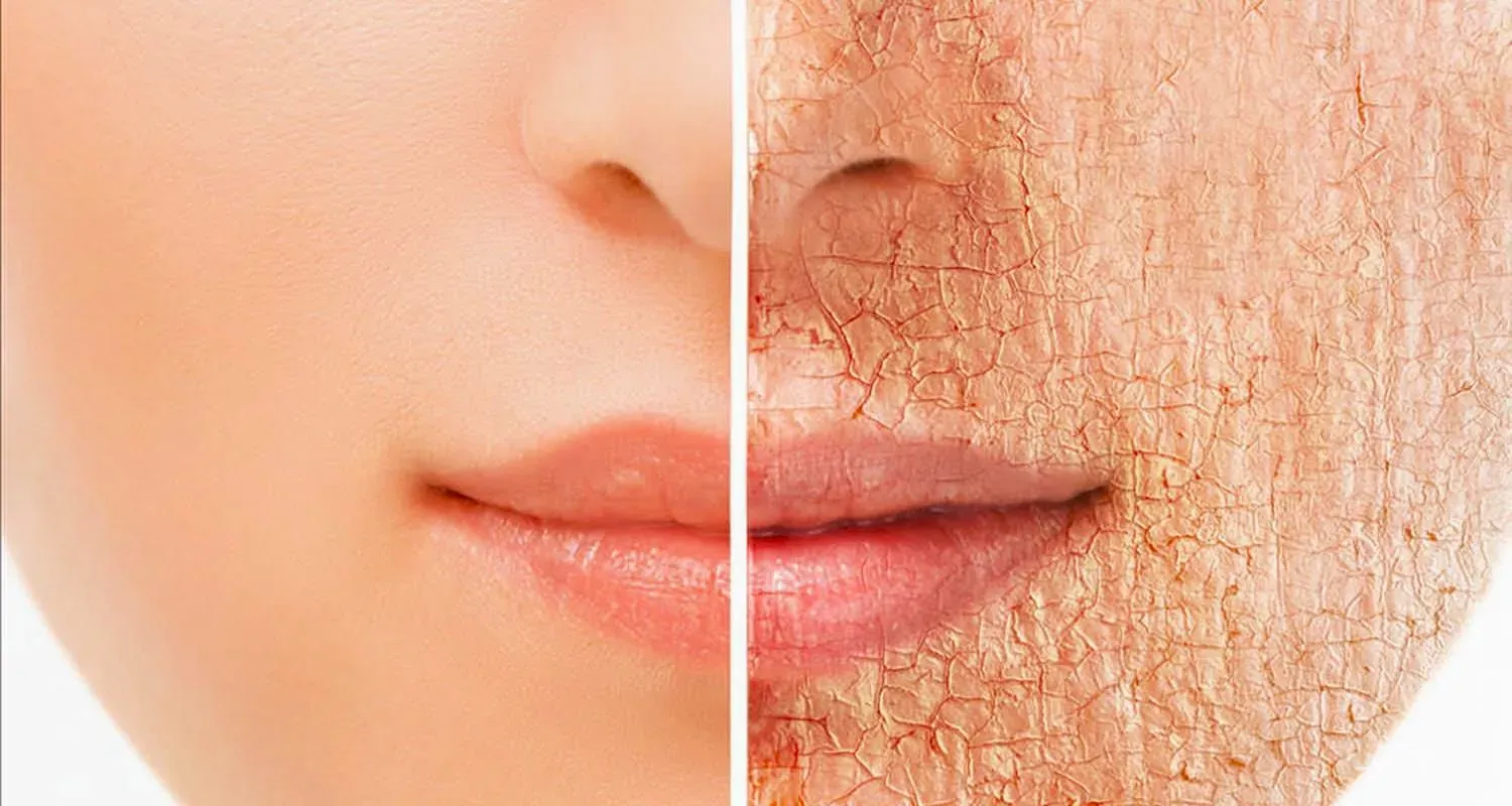 Шелушения кожи: причины, лечение